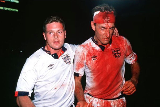 Paul Gascoigne y Terry Butcher tras el Suecia vs Inglaterra de 1989 - Odio Eterno Al Fútbol Moderno  